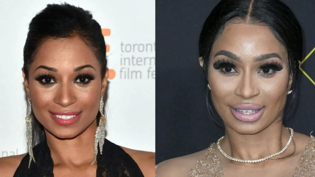 Karlie Redd Before Plastic Surgery: The 48-Years-Old Singer’s Face Has ...