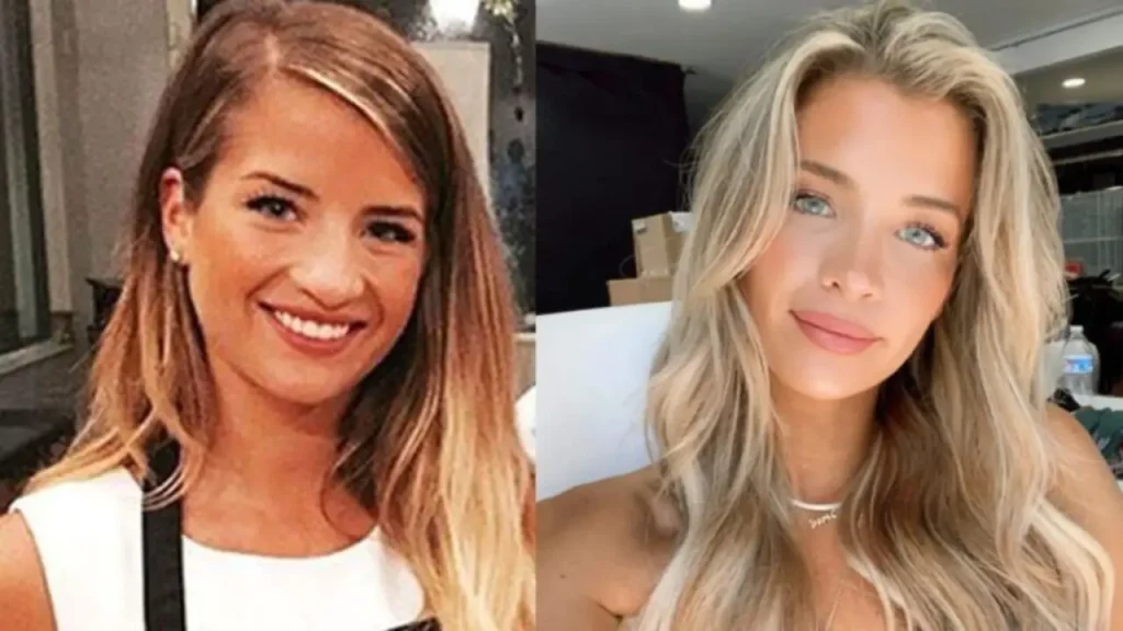 Naomie Olindo’s Plastic Surgery The Southern Charm Cast’s Before and